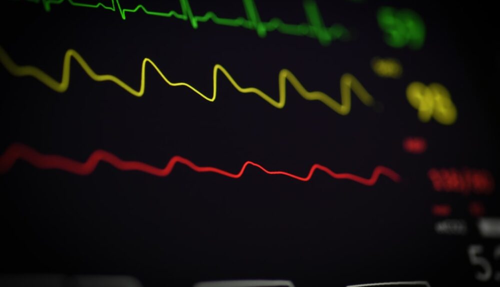 advancing cardiac imaging