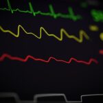 advancing cardiac imaging